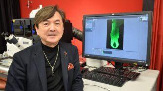 Cell Discovery Hints at Potential New Treatments for Hair Loss